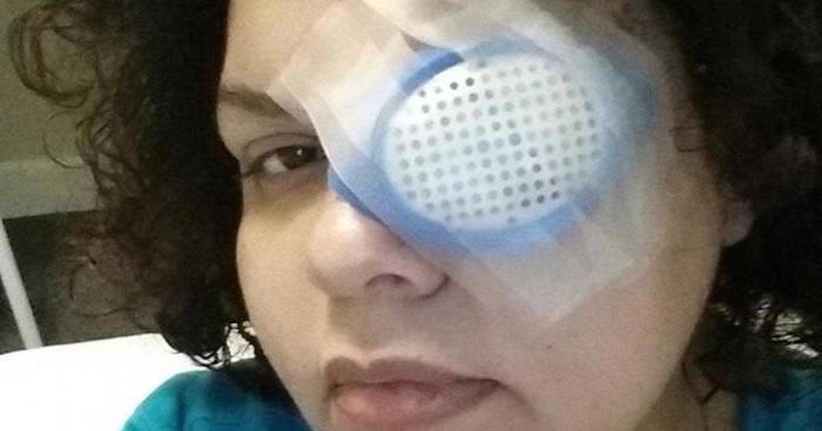 Ayudaba a su hija con una tarea de arte y terminó perdiendo un ojo. No