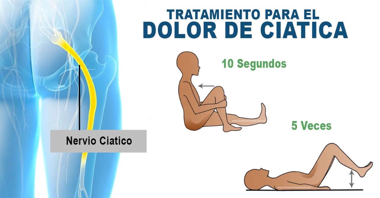 Medicamento para aliviar dolor de ciatica