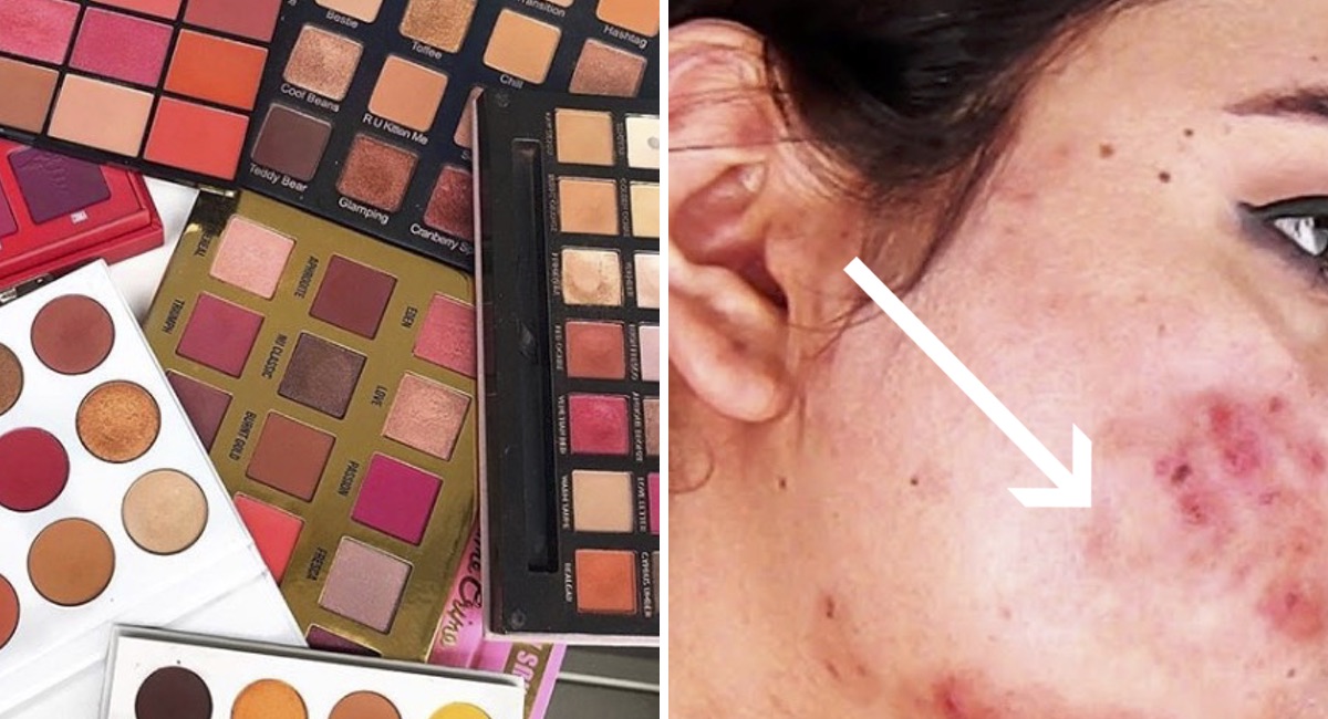 infecciones en la piel por maquillaje